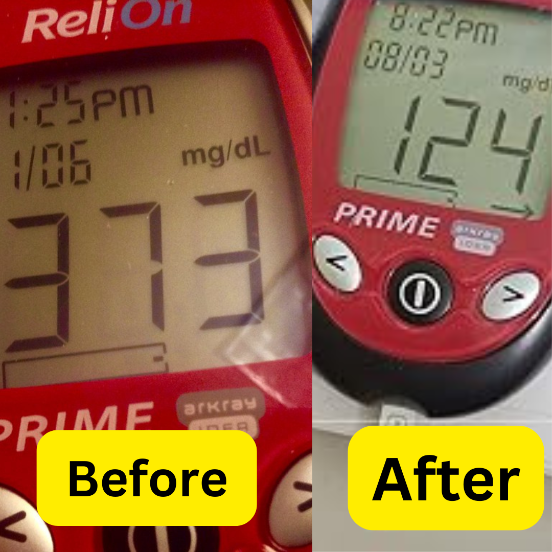 diabetes 1